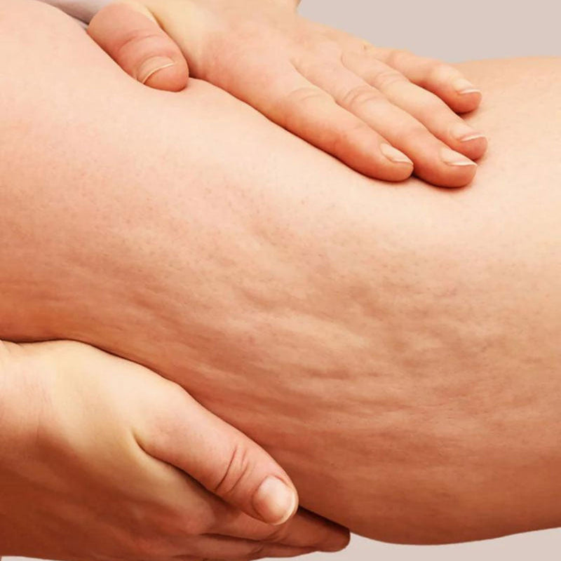 Adesivos corporais reutilizáveis para estrias e celulite