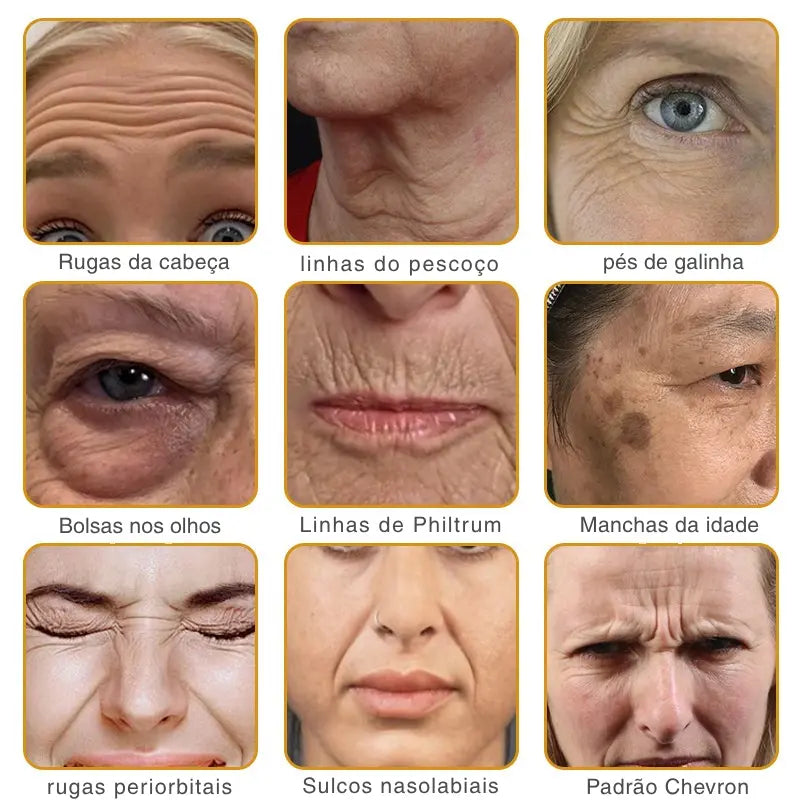 Creme antirrugas com veneno de abelha