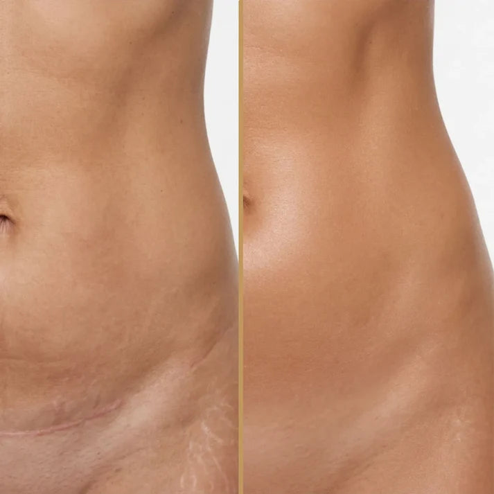 Corretivo corporal à prova d'água - cobertura para rosto e corpo