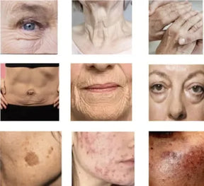 Rejuvenesça sua pele em 4 semanas — sem procedimentos invasivos, agulhas ou clínicas caras
