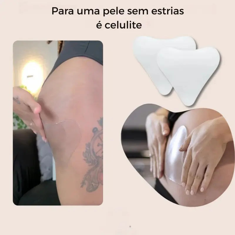 Adesivos corporais reutilizáveis para estrias e celulite