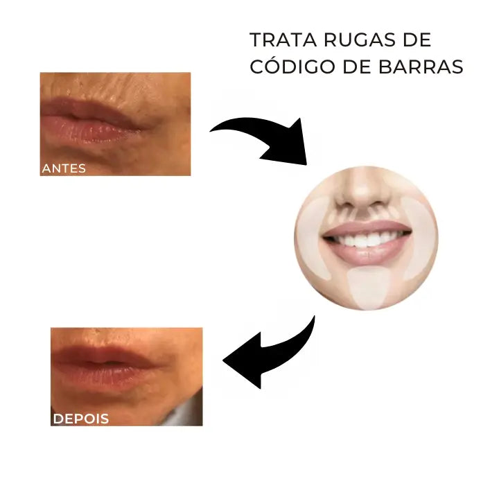 Adesivos faciais reutilizáveis antirrugas - 16 unidades
