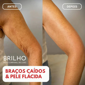 Óleo Corporal Beladermy | Firma a pele flácida em 97% em apenas 24 horas!
