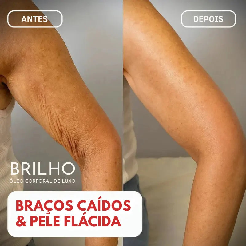 Óleo Corporal Beladermy | Firma a pele flácida em 97% em apenas 24 horas!