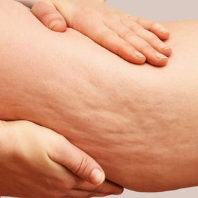 Adesivos corporais reutilizáveis para estrias e celulite