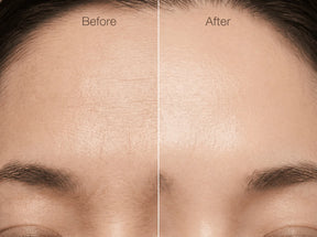 Massageador Facial EMS Redutor de Rugas 7 em 1