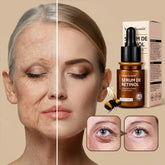 Retinol Sérum facial avançado de veneno de abelha anti-envelhecimento